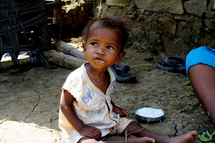 Nutrition norms issued to tackle severe acute malnutrition 
